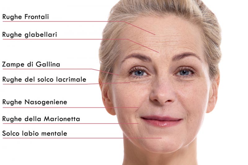 Rughe della Fronte | Cause e Rimedi per Combatterle