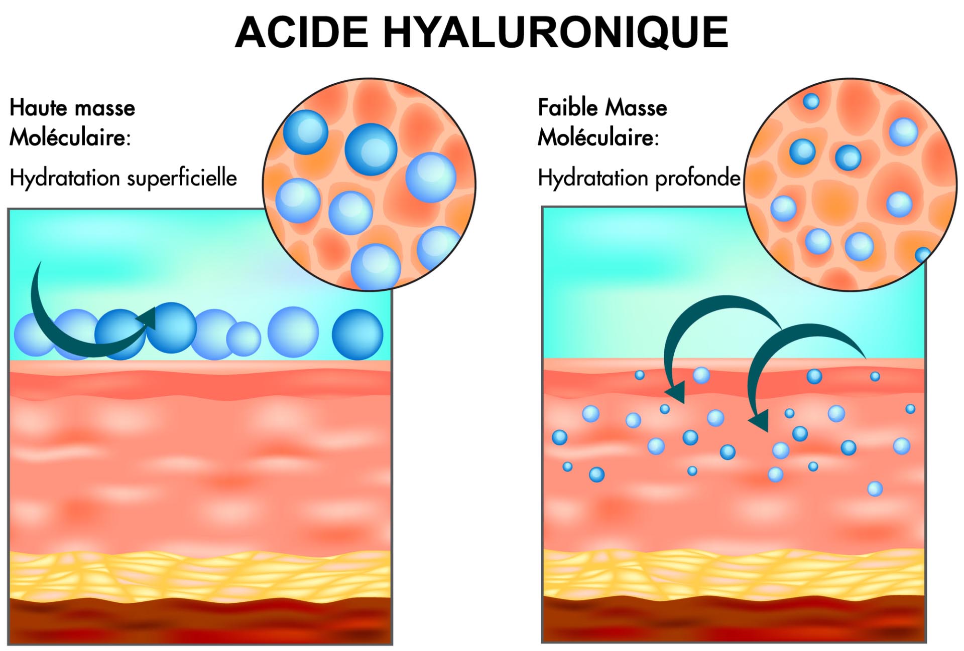 Acide Hyaluronique hydratation