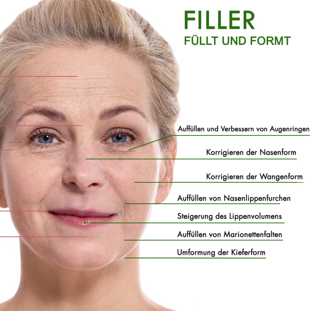 filler-de | X115®