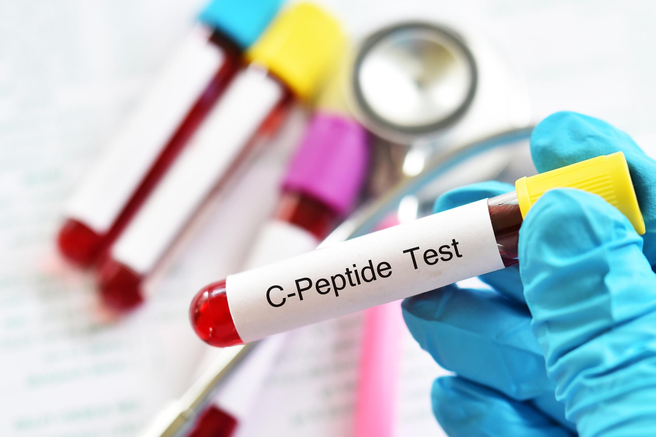 Peptide C, Analisi del Sangue