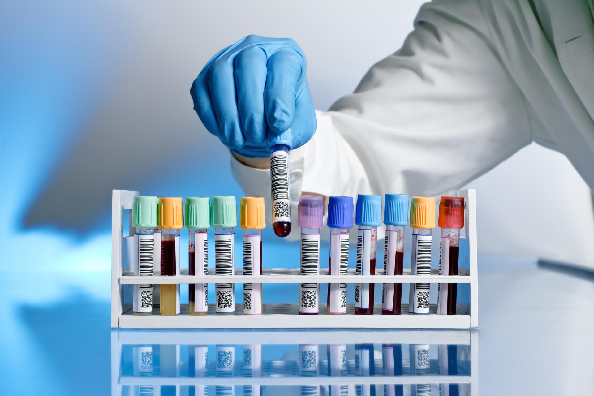 Infiammazione Esami del Sangue PCR, VES, PCT, IL6 X115® Infiammazione Esami del Sangue PCR, VES, PCT, IL6 X115®
