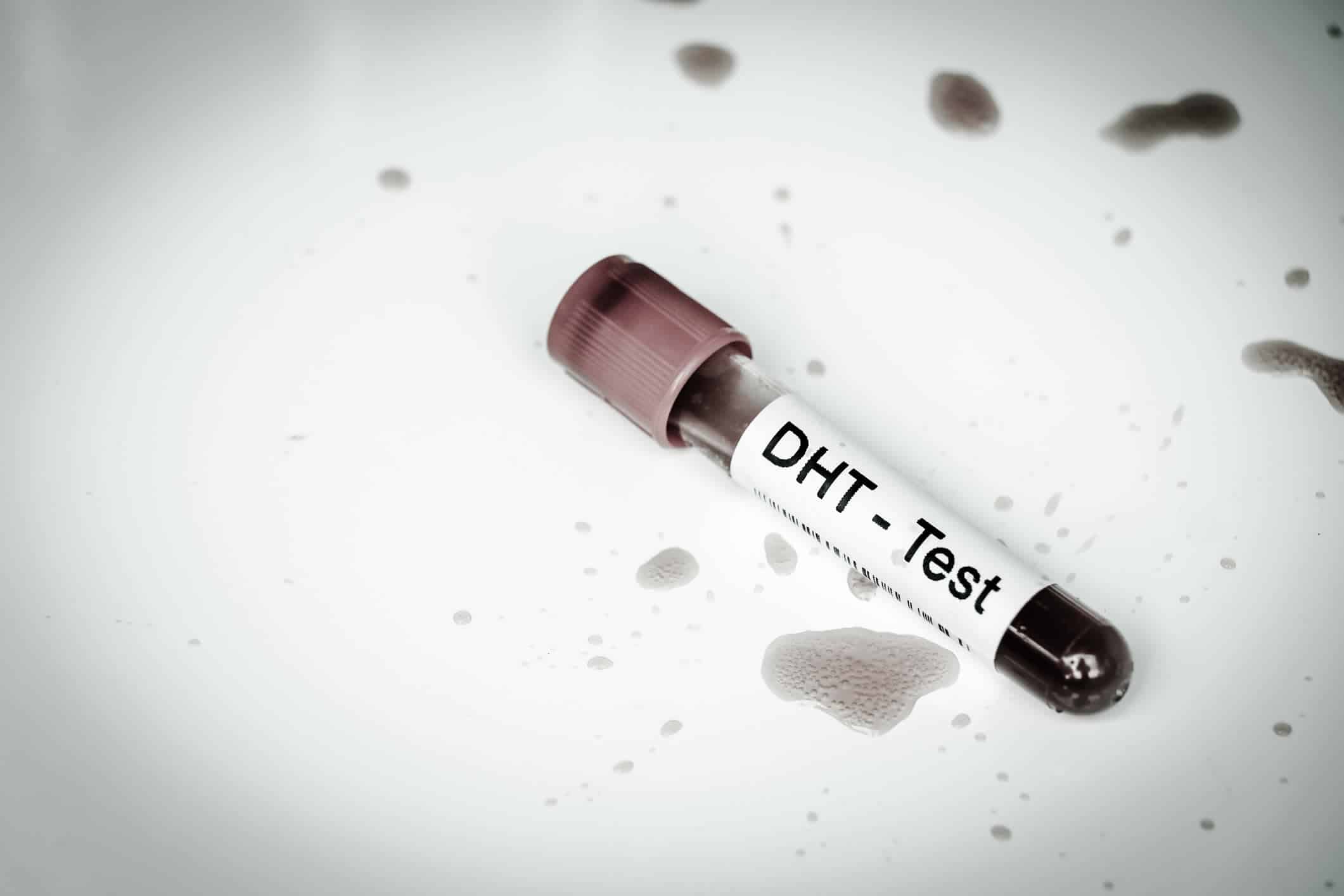 DHT diidrotestosterone