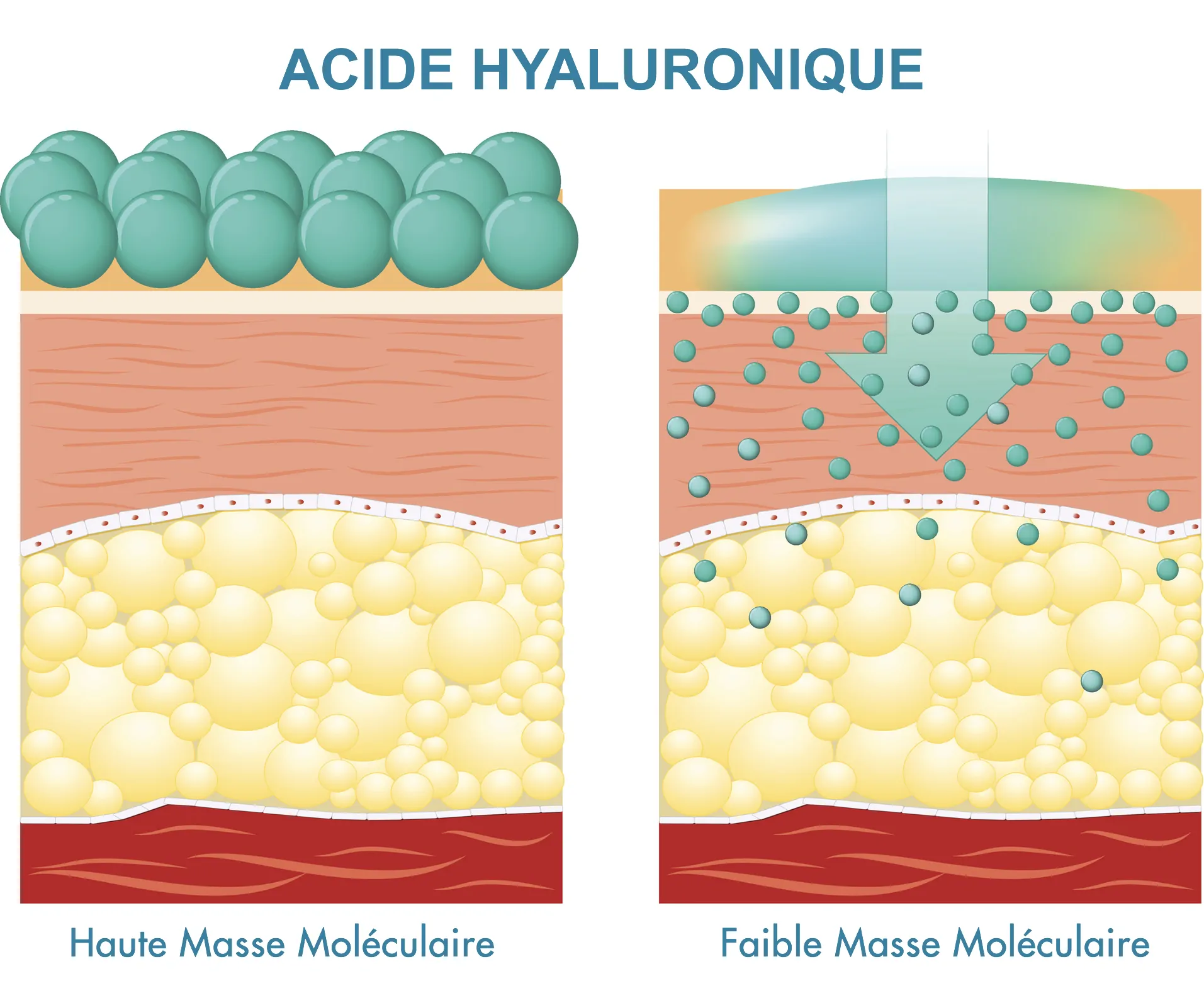 ACIDE HYALURONIQUE Masse Moléculaire