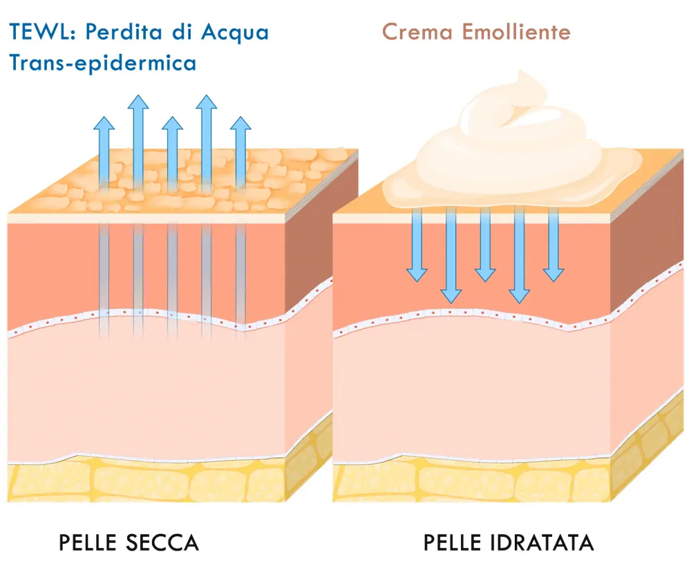 Creme emollienti