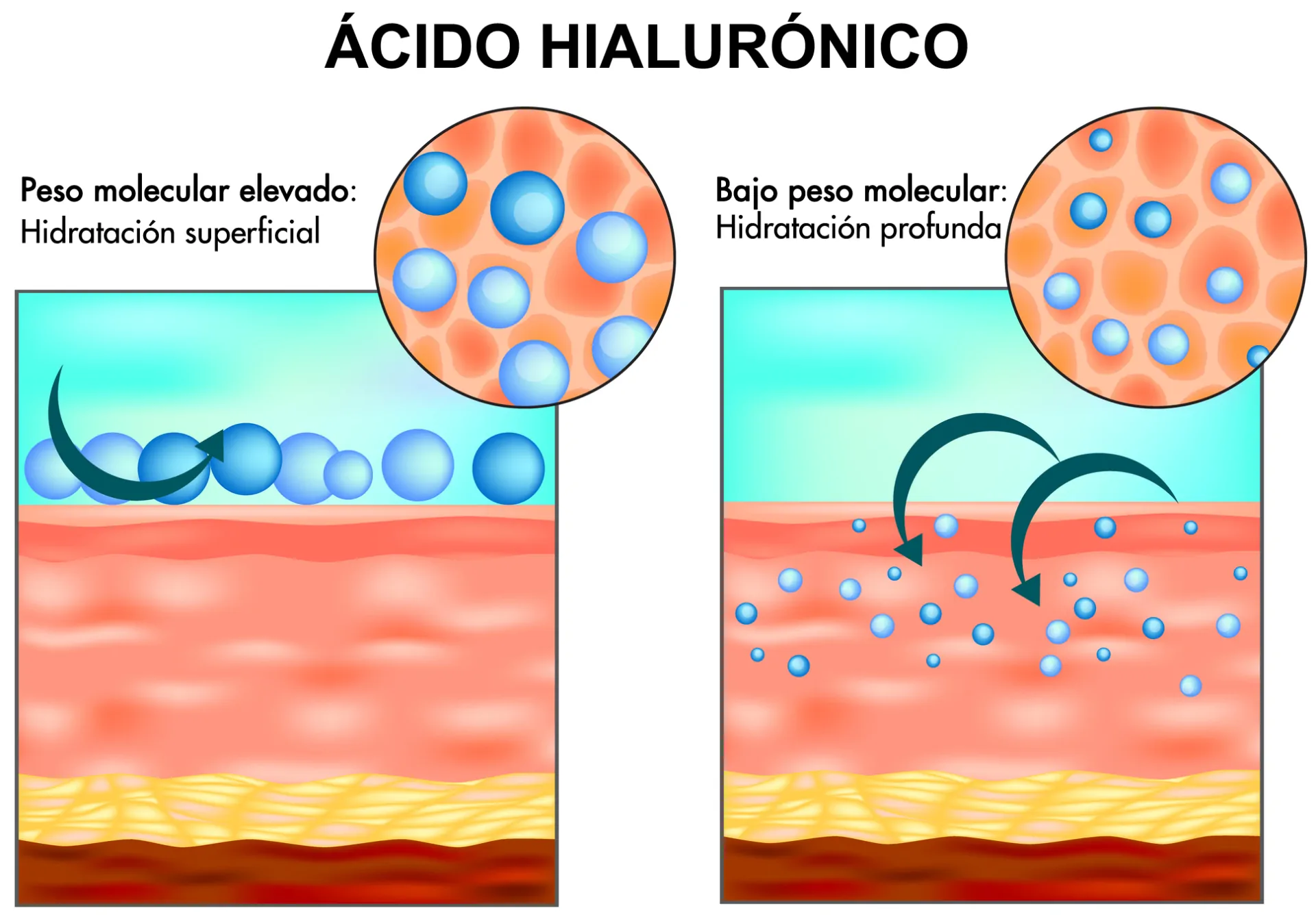 Ácido hialurónico peso molecular